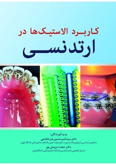 عکس کاربرد الاستیک ها در ارتدنسی