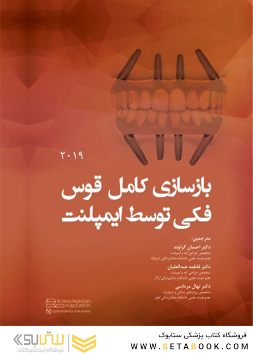 بازسازی کامل قوس فکی توسط ایمپلنت 2019