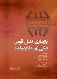 عکس بازسازی کامل قوس فکی توسط ایمپلنت 2019