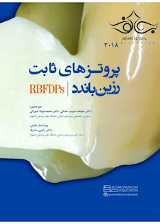 عکس پروتزهای ثابت رزین و باندد 2018