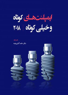 عکس ایمپلنت های کوتاه و خیلی کوتاه 2018