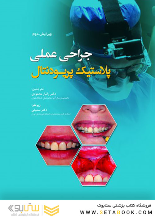 جراحی عملی پلاستیک پریودنتال