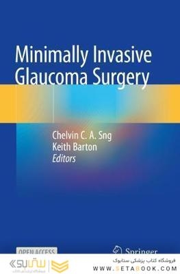 Minimally Invasive Glaucoma Surgery 1st ed
