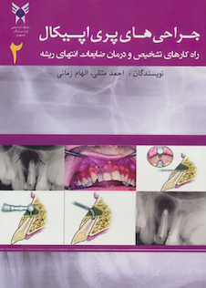 عکس جراحی های پری اپیکال 2 راهکارهای تشخیص و درمان ضایعات انتهای ریشه