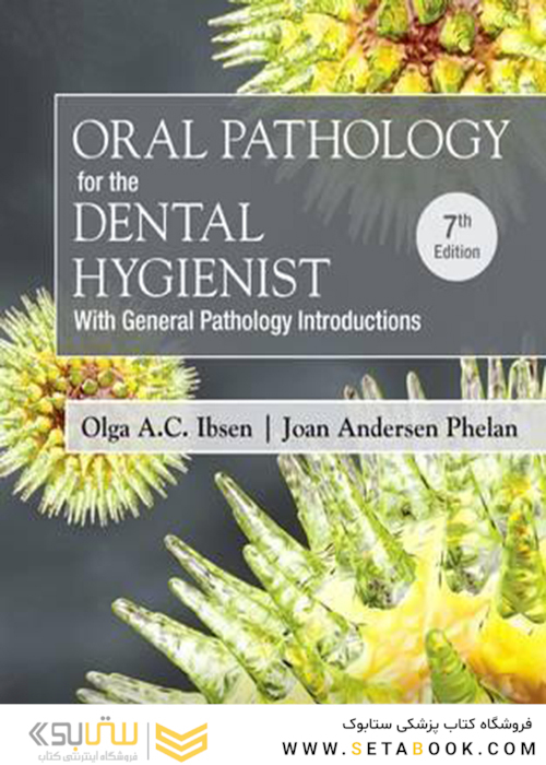 Oral Pathology for the Dental Hygienist 7th Edition2017