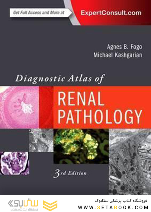 Diagnostic Atlas of Renal Pathology 3rd Edition2016 اطلس تشخیصی آسیب شناسی کلیه