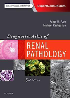 عکس Diagnostic Atlas of Renal Pathology 3rd Edition2016 اطلس تشخیصی آسیب شناسی کلیه