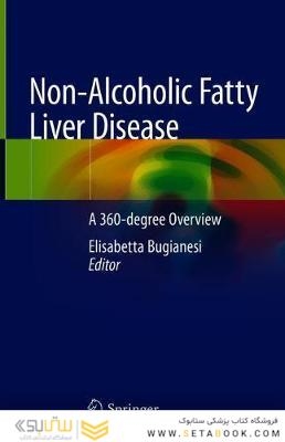 Non-Alcoholic Fatty Liver Disease: A 360-degree Overview 1st ed