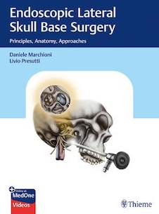 عکس Endoscopic Lateral Skull Base Surgery