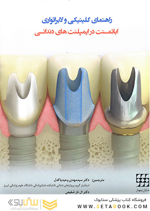 راهنمای کلینیکی و لابراتواری اباتمنت در ایمپلنت های دندانی