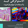 الاستوگرافی کبد با استفاده از امواج فراصوت