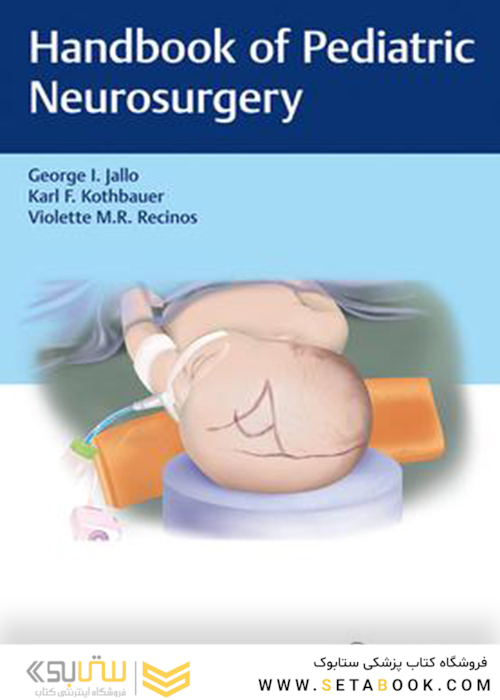 Handbook of Pediatric Neurosurgery 1st Edition2018