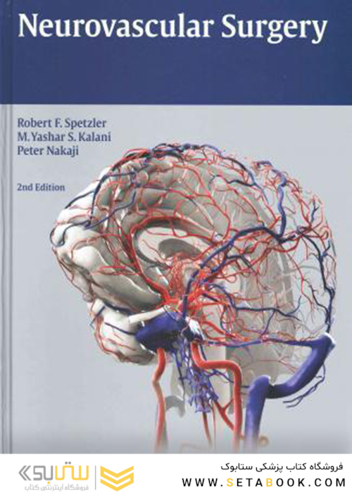 Neurovascular Surgery 2nd Edition2015