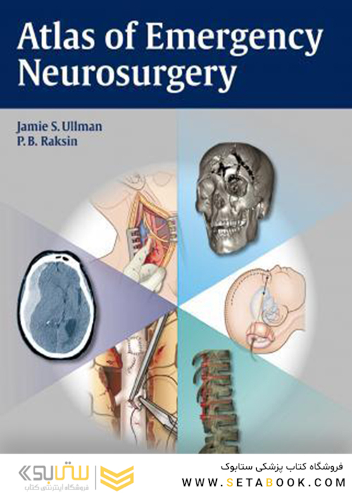 Atlas of Emergency Neurosurgery