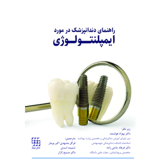 عکس راهنمای دندانپزشک در مورد ایمپلنتولوژی