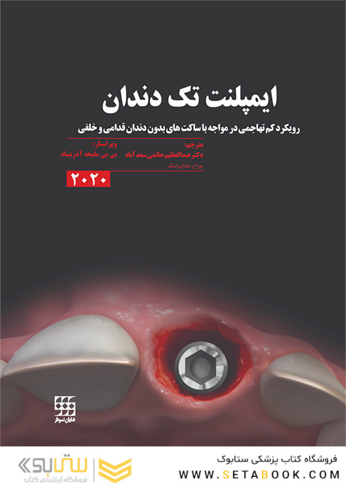 ایمپلنت تک دندان 2020