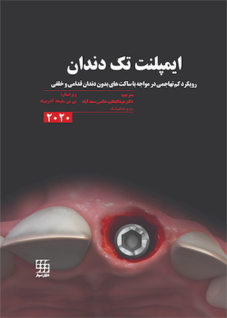 عکس ایمپلنت تک دندان 2020