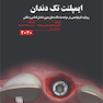 ایمپلنت تک دندان 2020