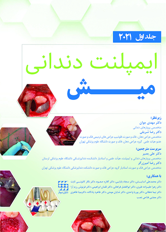 عکس ایمپلنت دندانی میش 2021 جلد اول