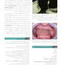ایمپلنت دندانی میش 2021 جلد اول