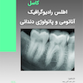 اطلس رادیوگرافیک آناتومی و پاتولوژی دندانی کاسل