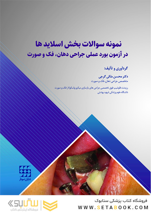 نمونه سوالات بخش اسلایدها در آزمون بورد عملی جراحی دهان، فک و صورت