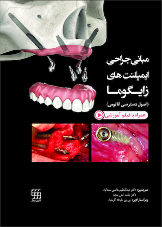 عکس مبانی جراحی ایمپلنت های زایگوما (اصول دسترسی آناتومی)