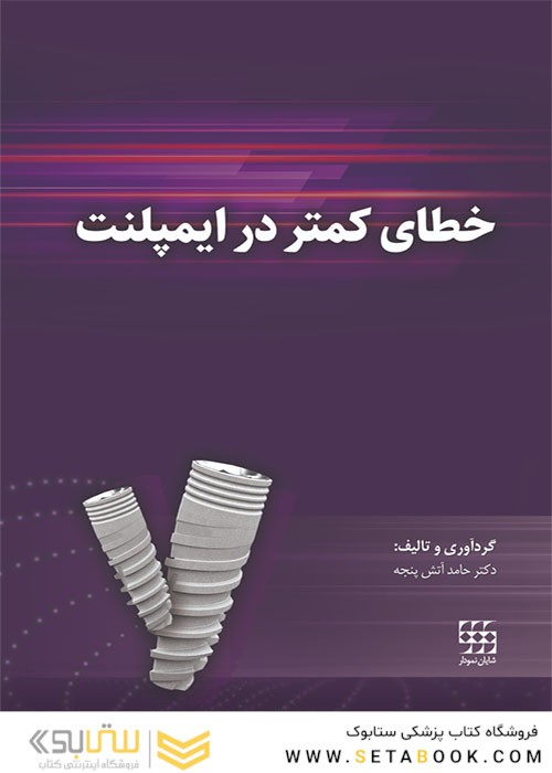 خطای کمتر در ایمپلنت