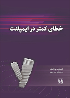 عکس خطای کمتر در ایمپلنت