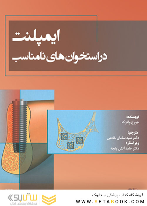ایمپلنت در استخوان های نامناسب