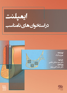 عکس ایمپلنت در استخوان های نامناسب