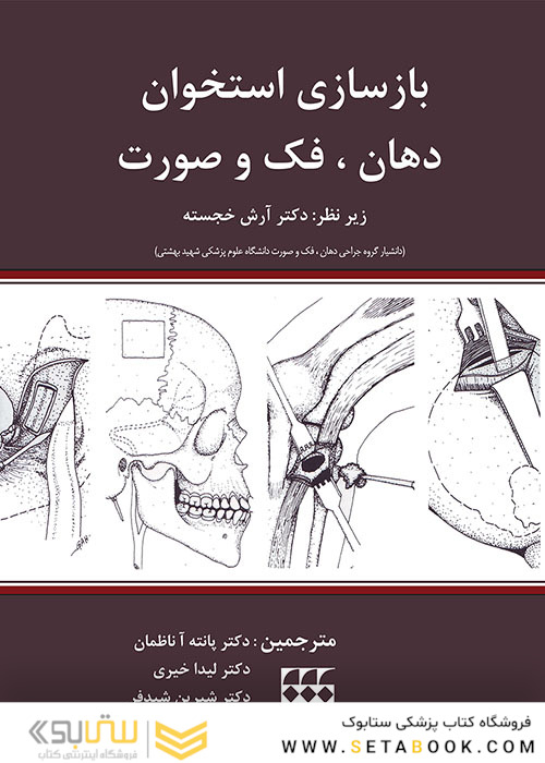 بازسازی استخوان دهان فک و صورت