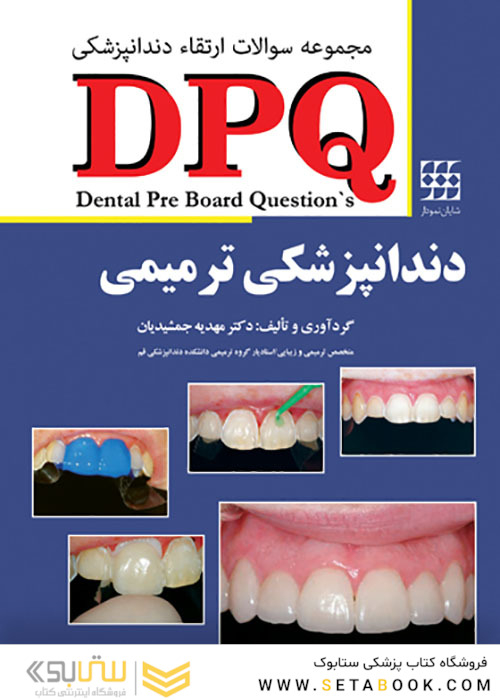 DPQ مجموعه سوالات ارتقاء دندانپزشکی دندانپزشکی ترمیمی