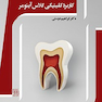 کاربرد کلینیکی گلاس آینومر  آموزش عملی کاربردی کلینیکی گلاس آینومر