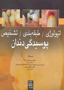 عکس اتیولوژی طبقه بندی تشخیص پوسیدگی دندان