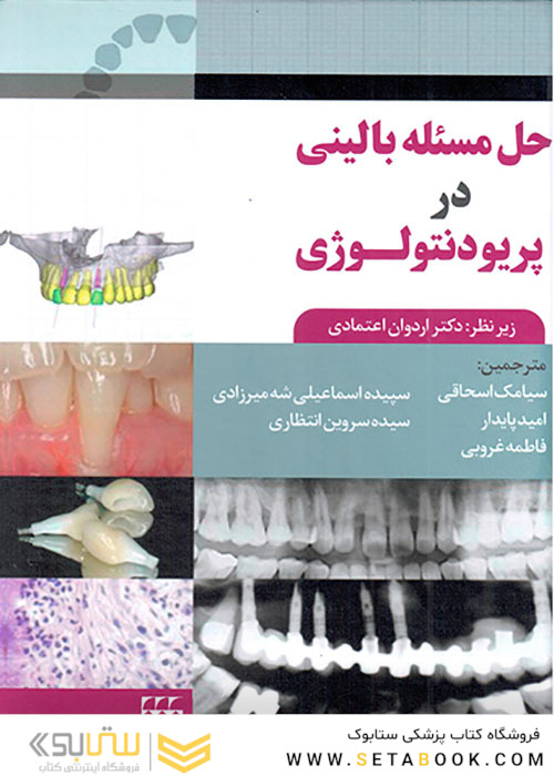 حل مساله بالینی در پریودنتولوژی