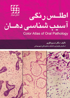 عکس اطلس رنگی آسیب شناسی دهان