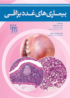 عکس بیماری های غدد بزاقی