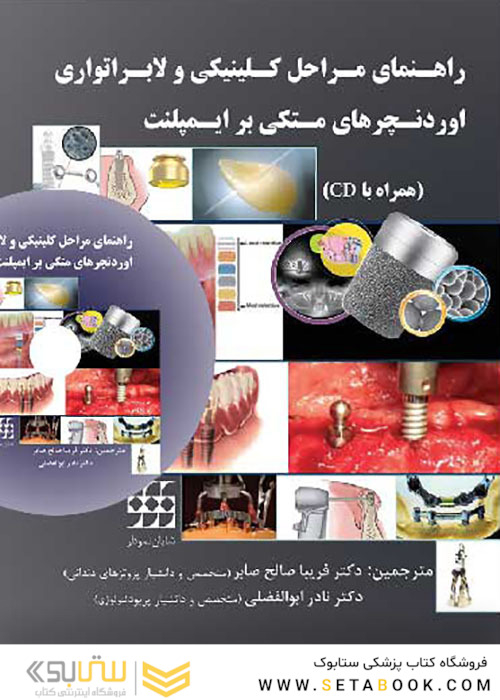 راهنمای مراحل کلینیکی و لابراتواری اوردنچرهای متکی بر ایمپلنت