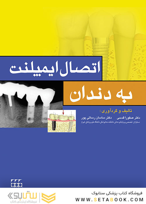 اتصال ایمپلنت به دندان