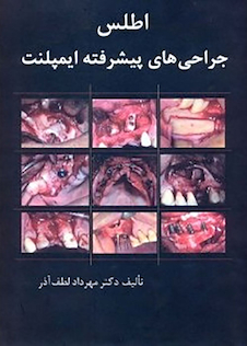 عکس اطلس جراحی های پیشرفته ایمپلنت جلد 1