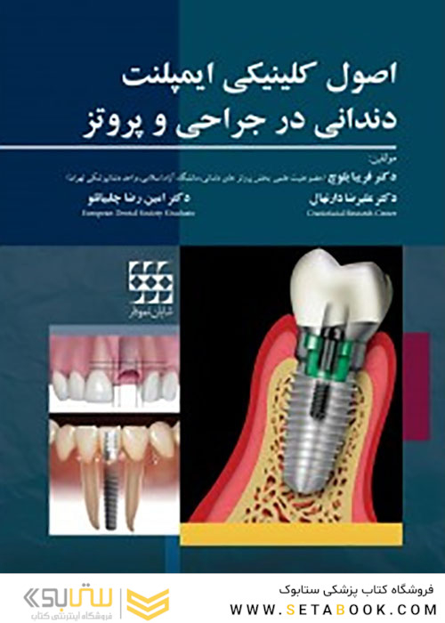اصول کلینیکی ایمپلنت دندانی در جراحی و پروتز