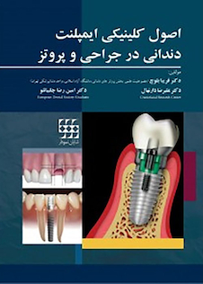 عکس اصول کلینیکی ایمپلنت دندانی در جراحی و پروتز