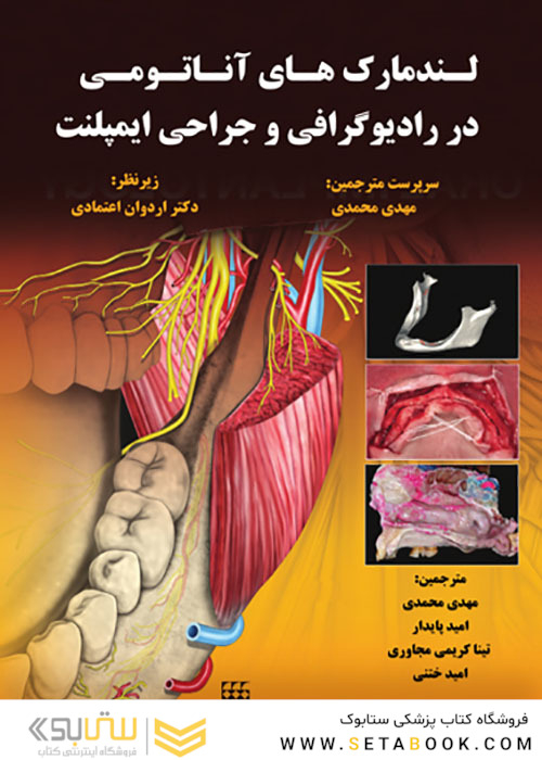 لندمارک های آناتومی در رادیوگرافی و جراحی ایمپلنت