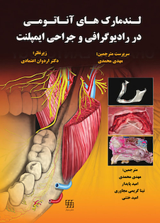 عکس لندمارک های آناتومی در رادیوگرافی و جراحی ایمپلنت