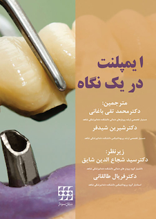 عکس ایمپلنت در یک نگاه