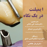 ایمپلنت در یک نگاه