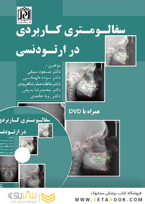 سفالومتری کاربردی در ارتودنسی