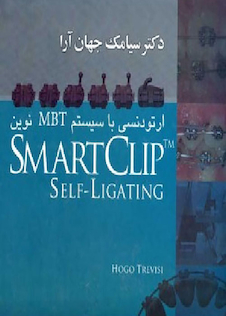 عکس ارتودنسی با سیستم MBT نوین SMART CLIP TM SELF LIGATING