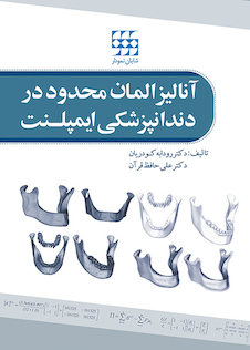 عکس آنالیز المان محدود در دندانپزشکی ایمپلنت